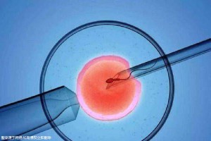 极光生殖